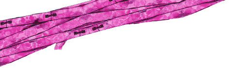 bandage